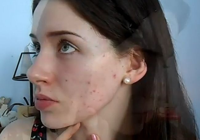 Transformare incredibila cu ajutorul machiajului: cum reuseste o tanara cu fata atacata de acnee sa aiba un ten impecabil