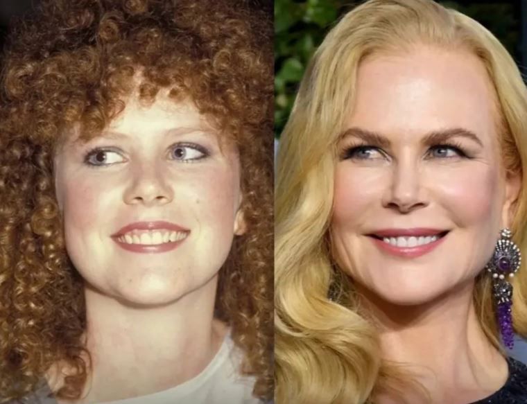Cum arată chipul lui Nicole Kidman la 54 de ani. Actrița a făcut abuz de botox &icirc;n trecut, iar acum fanii o suspectează din nou
